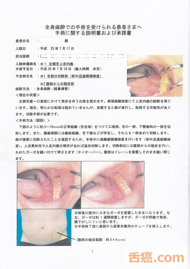 舌癌の手術承諾書